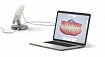 Цифровой сканер - одна из самых последних разработок в области стоматологии