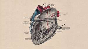 Дела сердечные: роботизированный правый желудочек
