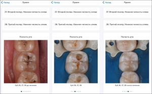 Наш пациент имеет доступ к карточке, фотографиям вмешательств, γ-снимкам зубов и всем протоколам лечения
