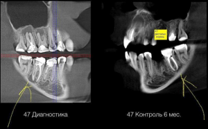 Про очень терпеливую девушку, которой хотели удалить 6 зубов