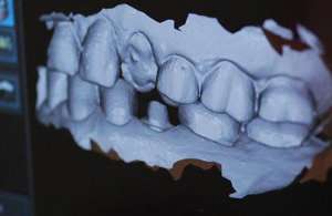 Роботизированная стоматология концепт