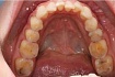 Типичные зубы пациента-айтишника: что с ними не так